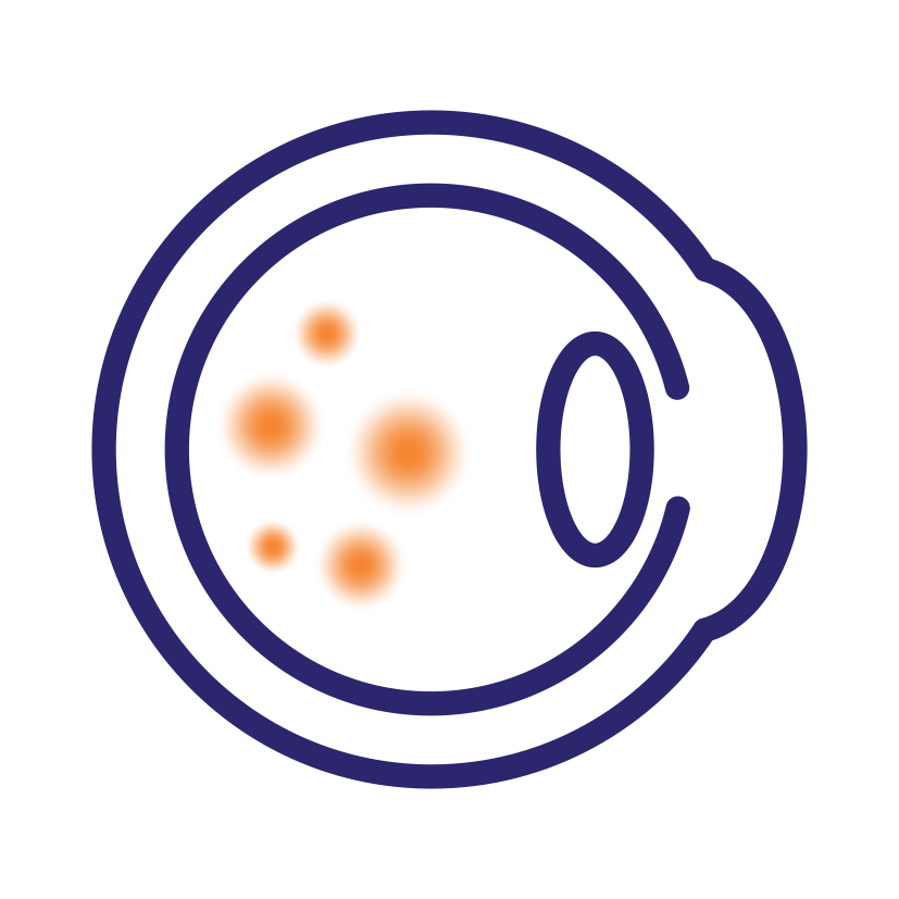 Macular Degeneration
