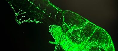 Myopia research in focus: <br>Three groundbreaking approaches